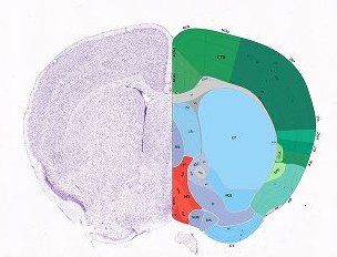 Interactive Atlas Viewer :: Atlas Viewer Interactive Atlas Viewer :: Atlas Viewer