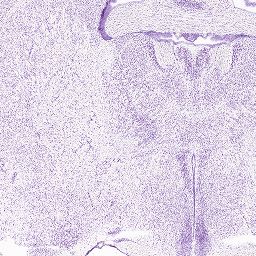 Interactive Atlas Viewer :: Atlas Viewer