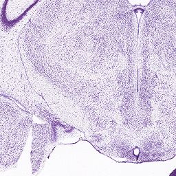 Interactive Atlas Viewer :: Atlas Viewer