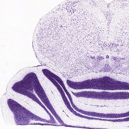 Interactive Atlas Viewer :: Atlas Viewer